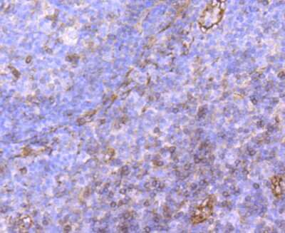 Immunohistochemistry-Paraffin: P-Selectin/CD62P Antibody (JM10-95) [NBP2-67080] - Analysis of paraffin-embedded human tonsil tissue using anti-CD62P antibody. Counter stained with hematoxylin.