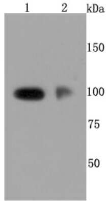 Western Blot: P-Selectin/CD62P Antibody (JM10-95) [NBP2-67080] - Analysis of CD62P on different cells lysates using anti-CD62P antibody at 1/500 dilution. Positive control: Line1: HUVEC Line2: Human placenta