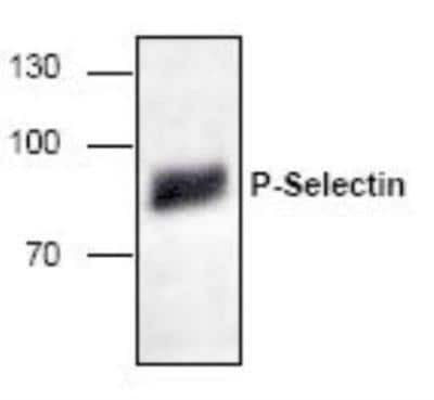 Western Blot: P-Selectin/CD62P Antibody [NBP1-50764] -  Analysis of P-Selectin expression in Jurkat cell lysate.
