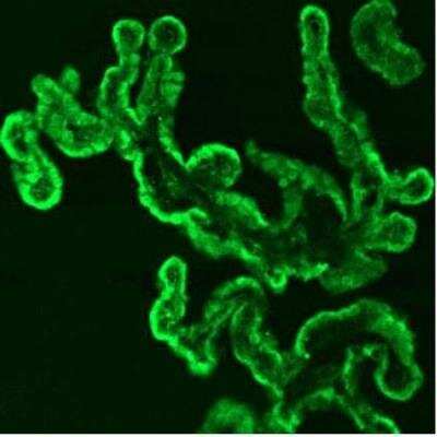 Immunocytochemistry/Immunofluorescence: P11 Antibody [NB100-40907] - P11 in rat choroid plexus and FITC-conjugated donkey anti-chicken secondary antibodies