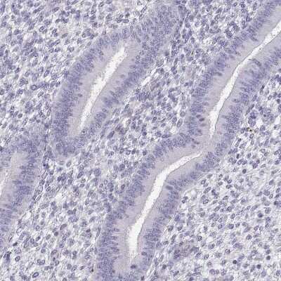 Immunohistochemistry-Paraffin: P11 Antibody [NBP2-55877] - Staining of human endometrium shows no positivity in glandular cells as expected.