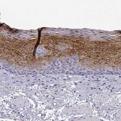 Immunohistochemistry-Paraffin: P11 Antibody [NBP2-55877] - Staining of human esophagus shows strong cytoplasmic positivity in squamous epithelial cells.