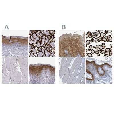 <b>Independent Antibodies Validation. </b>Immunohistochemistry-Paraffin: P11 Antibody [NBP2-55877] - Staining of human esophagus, placenta, skeletal muscle and skin using Anti-ENDOU antibody NBP2-55877 (A) shows similar protein distribution across tissues to independent antibody NBP1-82458 (B).