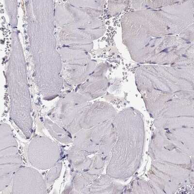 Immunohistochemistry-Paraffin: P11 Antibody [NBP2-55877] - Staining of human skeletal muscle shows no positivity in myocytes as expected.