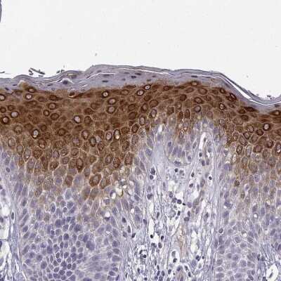 Immunohistochemistry-Paraffin: P11 Antibody [NBP2-55877] - Staining of human skin shows strong cytoplasmic positivity in squamous epithelial cells.