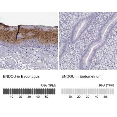 <b>Orthogonal Strategies Validation. </b>Immunohistochemistry-Paraffin: P11 Antibody [NBP2-55877] - Staining in human esophagus and endometrium tissues using NBP2-55877 antibody. Corresponding ENDOU RNA-seq data are presented for the same tissues.