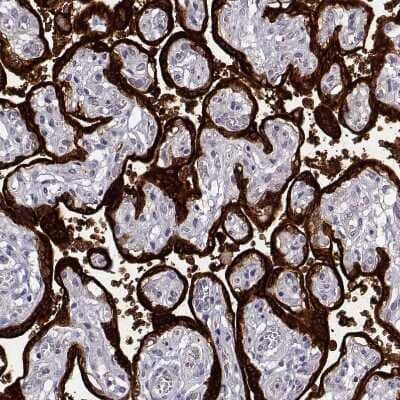 Immunohistochemistry-Paraffin: P11 Antibody [NBP2-55877] - Staining of human placenta shows very strong cytoplasmic positivity in trophoblastic cells.