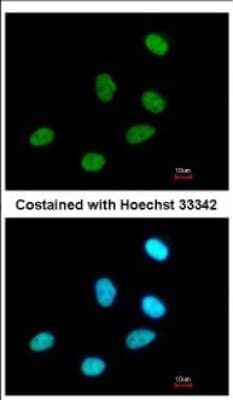 Immunocytochemistry/Immunofluorescence: P15RS Antibody [NBP2-19650] - Immunofluorescence analysis of paraformaldehyde-fixed A549, using antibody at 1:500 dilution.