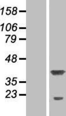 Western Blot: P15RS Overexpression Lysate (Adult Normal) [NBP2-06863] Left-Empty vector transfected control cell lysate (HEK293 cell lysate); Right -Over-expression Lysate for P15RS.