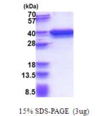 SDS-PAGE Recombinant Human P15RS His Protein