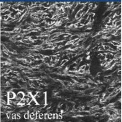 Immunohistochemistry: P2X1/P2RX1 Antibody [NB100-1651] -  Vas Deferens