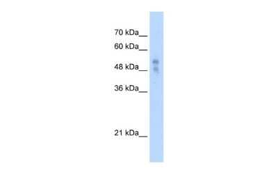 Western Blot: P2X1/P2RX1 Antibody [NBP2-86742] - WB Suggested Anti-P2RX1 Antibody Titration: 2.5ug/ml. ELISA Titer: 1:312500. Positive Control: HepG2 cell lysate