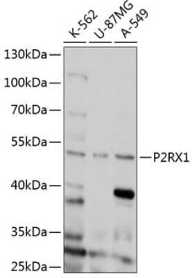Western Blot: P2X1/P2RX1 Antibody [NBP3-03143] - Analysis of extracts of various cell lines, using P2x1/P2Rx1 antibody at 1:1000 dilution. Secondary antibody: HRP Goat Anti-Rabbit IgG (H+L) at 1:10000 dilution. Lysates/proteins: 25ug per lane. Blocking buffer: 3% nonfat dry milk in TBST. Detection: ECL Kit
