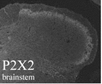 Immunohistochemistry: P2X2/P2RX2 Antibody [NB100-1652] - P2X2/P2RX2 is expressed in brain, spinal cord, sensory and autonomic ganglia as well as in neuroendocrine cells
