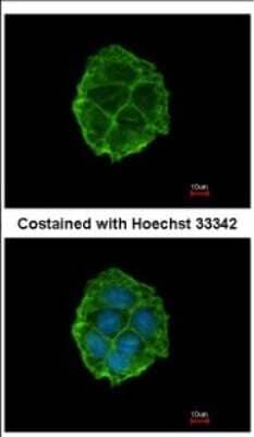 Immunocytochemistry/Immunofluorescence: P2X3 Antibody [NBP2-19657] - Immunofluorescence analysis of methanol-fixed MCF-7, using antibody at 1:500 dilution.