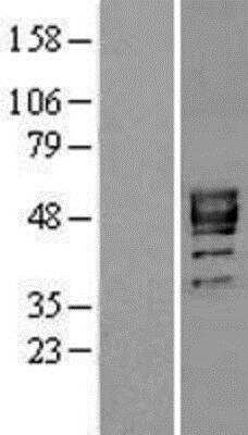 Western Blot: P2X3 Overexpression Lysate (Adult Normal) [NBL1-14030] - Left - Empty vector transfected control cell lysate (HEK293 cell lysate); Right - Over-expression Lysate for P2X3.