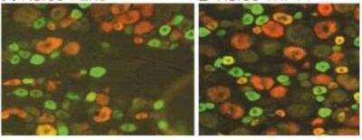 Immunohistochemistry-Paraffin: P2X3/P2RX3 Antibody [NB100-1654] - DRG sections double-labeled for ASIC3 (red) and either P2X3 (green, A) or TRPV1 (green, B); double-labeled cells are yellow or orange