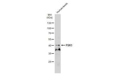 Western Blot: P2X3/P2RX3 Antibody [NBP2-19657] - Human tissue extract (30 ug) was separated by 10% SDS-PAGE, and the membrane was blotted with P2X3 antibody diluted at 1:500. HRP-conjugated anti-rabbit IgG antibody was used to detect the primary antibody.