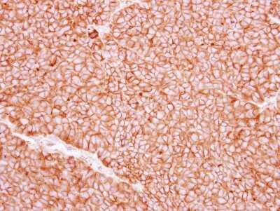 Immunohistochemistry-Paraffin: P2X5 Antibody [NBP2-19659] - Immunohistochemical analysis of paraffin-embedded PC13 xenograft, using antibody at 1:250 dilution.