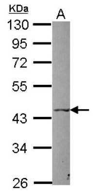 Western Blot: P2X5 Antibody [NBP2-19659] - Sample (30 ug of whole cell lysate) A: Raji 10% SDS PAGE gel, diluted at 1:1000.