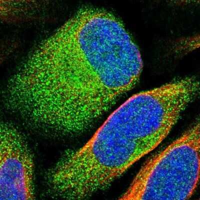 Immunocytochemistry/Immunofluorescence: P2X5/P2RX5 Antibody [NBP1-82441] - Immunofluorescent staining of human cell line U-2 OS shows localization to cytosol.