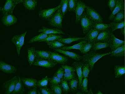 Immunocytochemistry/Immunofluorescence: P2X5/P2RX5 Antibody [NBP2-98199] - Immunofluorescence staining of P2X5/P2RX5 in U2OS cells. Cells were fixed with 4% PFA, permeabilzed with 0.1% Triton X-100 in PBS, blocked with 10% serum, and incubated with rabbit anti-Human P2X5/P2RX5 polyclonal antibody (dilution ratio 1:200) at 4C overnight. Then cells were stained with the Alexa Fluor(R)488-conjugated Goat Anti-rabbit IgG secondary antibody (green) and counterstained with DAPI (blue).Positive staining was localized to Cytoplasm and cell membrane.