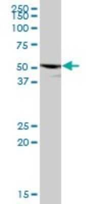 Western Blot: P2X5/P2RX5 Antibody [H00005026-B01P] - Analysis of P2RX5 expression in human pancreas.