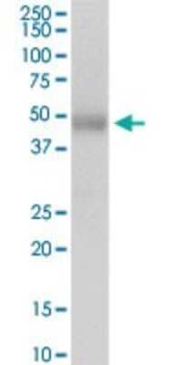 Western Blot: P2X5/P2RX5 Antibody [H00005026-D01P] - Analysis of P2RX5 expression in human colon.