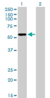 Western Blot: P2X5/P2RX5 Antibody [H00005026-D01P] - Analysis of P2RX5 expression in transfected 293T cell line by P2RX5 polyclonal antibody.Lane 1: P2RX5 transfected lysate(47.20 KDa).Lane 2: Non-transfected lysate.