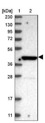Western Blot: P2X5/P2RX5 Antibody [NBP1-82441] - Lane 1: Marker  [kDa] 230, 130, 95, 72, 56, 36, 28, 17, 11.  Lane 2: Human cell line RT-408