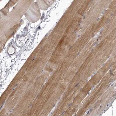 Immunohistochemistry-Paraffin: P2X6/P2RX6 Antibody [NBP2-48583] - Staining of human skeletal muscle shows moderate cytoplasmic positivity in myocytes.