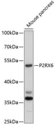 Western Blot: P2X6/P2RX6 Antibody [NBP2-93169] - Analysis of extracts of mouse pancreas, using P2X6/P2RX6 .Exposure time: 90s.