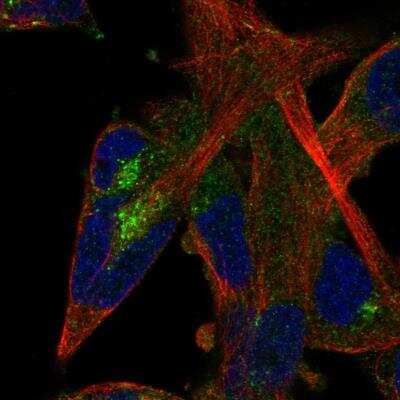 Immunocytochemistry/Immunofluorescence: P2X7/P2RX7 Antibody [NBP1-82739] - Staining of human cell line RH-30 shows localization to the Golgi apparatus. Antibody staining is shown in green.