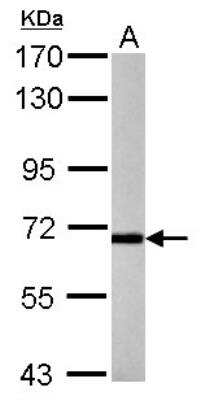 Western Blot: P2X7/P2RX7 Antibody [NBP2-19653] - Sample (50 ug of whole cell lysate) A: Mouse Brain, 7. 5% SDS PAGE gel, diluted at 1:1000.