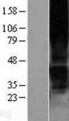 Western Blot: P2Y1 Overexpression Lysate (Native) [NBP2-04228] - P2Y1 Overexpression Lysate (Native) Left-Empty vector transfected control cell lysate (HEK293 cell lysate); Right -Over-expression Lysate for P2RY1.