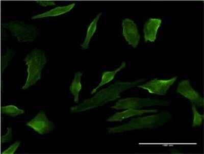 Immunocytochemistry/Immunofluorescence: P2Y1/P2RY1 Antibody (4C2) [H00005028-M01] - Analysis of monoclonal antibody to P2RY1 on HeLa cell . Antibody concentration 10 ug/ml.