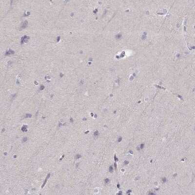 <b>Orthogonal Strategies Validation. </b>Immunohistochemistry-Paraffin: P2Y10/P2RY10 Antibody [NBP2-56283] - Staining of human cerebral cortex shows low expression as expected.