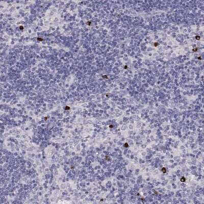 Immunohistochemistry-Paraffin: P2Y10/P2RY10 Antibody [NBP2-56283] - Staining of human lymph node shows high expression.