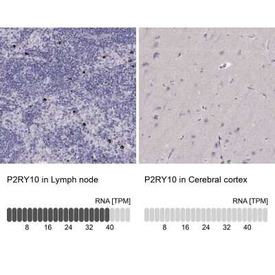 Immunohistochemistry-Paraffin: P2Y10/P2RY10 Antibody [NBP2-56283] - Staining in human lymph node and cerebral cortex tissues using anti-P2RY10 antibody. Corresponding P2RY10 RNA-seq data are presented for the same tissues.