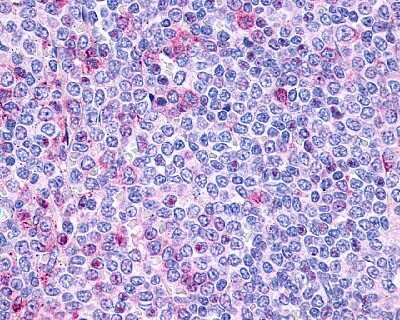 Immunohistochemistry-Paraffin: P2Y10/P2RY10 Antibody [NLS860] - Analysis of anti-P2RY10 / P2Y10 antibody with human spleen, lymphocytes.