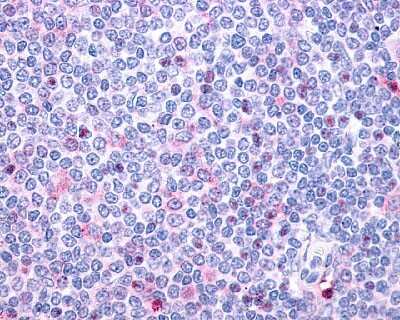 Immunohistochemistry-Paraffin: P2Y10/P2RY10 Antibody [NLS862] - Analysis of anti-P2RY10 / P2Y10 antibody with human spleen, lymphocytes at 6 ug/ml.