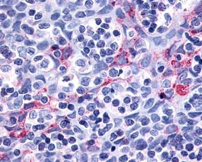 Immunohistochemistry-Paraffin: P2Y11/P2RY11 Antibody [NLS866] - Analysis of anti-P2RY11 / P2Y11 antibody with human dendritic cells.