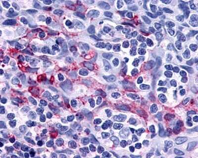 Immunohistochemistry-Paraffin: P2Y11/P2RY11 Antibody [NLS867] - Analysis of anti-P2RY11 / P2Y11 antibody with dendritic cells using this antibody at 8 ug/ ml.