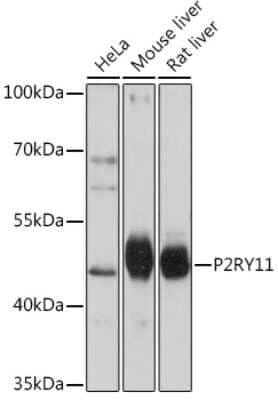 Western Blot: P2Y11/P2RY11 Antibody [NBP3-15501] - Western blot analysis of extracts of various cell lines, using P2Y11/P2RY11 Rabbit pAb (NBP3-15501) at 1:1000 dilution. Secondary antibody: HRP Goat Anti-Rabbit IgG (H+L) at 1:10000 dilution. Lysates/proteins: 25ug per lane. Blocking buffer: 3% nonfat dry milk in TBST. Detection: ECL Basic Kit. Exposure time: 10s.