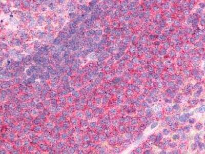Immunohistochemistry-Paraffin: P2Y13/P2RY13/GPR86 Antibody [NLS1619] - Analysis of anti-P2RY13 / P2Y13 antibody spleen, germinal center, mantle, and marginal zone.