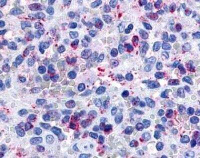 Immunohistochemistry-Paraffin: P2Y13/P2RY13/GPR86 Antibody [NLS1620] - Staining of human spleen.