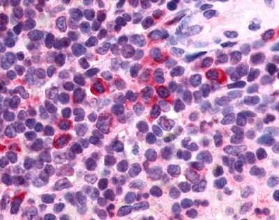 Immunohistochemistry-Paraffin: P2Y13/P2RY13/GPR86 Antibody [NLS1622] - Analysis of anti-P2RY13 / P2Y13 antibody with human spleen.