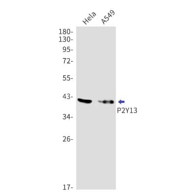 Western Blot: P2Y13/P2RY13/GPR86 Antibody (S02-3I1) [NBP3-19904] - Western blot detection of P2Y13/P2RY13/GPR86 in Hela, A549 cell lysates using NBP3-19904 (1:1000 diluted). Predicted band size: 41kDa. Observed band size: 41kDa.