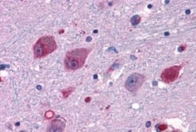 Immunohistochemistry-Paraffin: P2Y14/GPR105 Antibody [NBP3-14438] - Immunohistochemistry of formalin-fixed, paraffin-embedded human brain, neurons and glia, after heat-induced antigen retrieval.