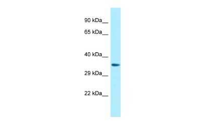 Western Blot: P2Y14/GPR105 Antibody [NBP2-86743] - WB Suggested Anti-P2RY14 Antibody. Titration: 1.0 ug/ml. Positive Control: Fetal Heart